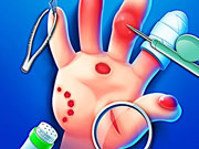 Tratamentul mainilor